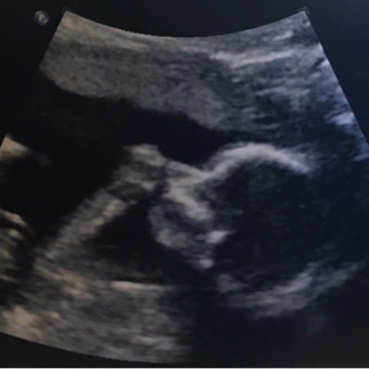 Babylist Registry Photo.