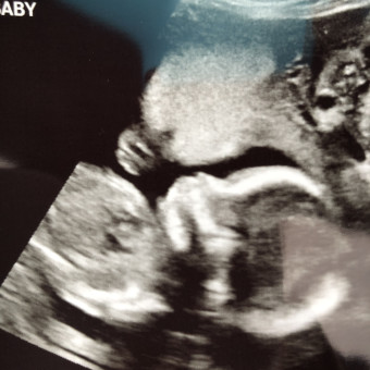 Babylist Registry Photo.