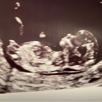 Babylist Registry Photo.