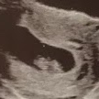 Babylist Registry Photo.