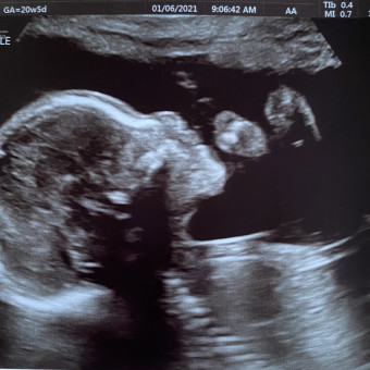 Babylist Registry Photo.