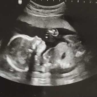 Babylist Registry Photo.