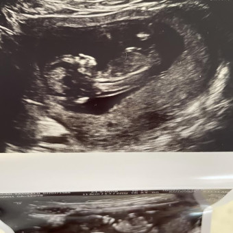 Babylist Registry Photo.