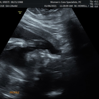 Babylist Registry Photo.