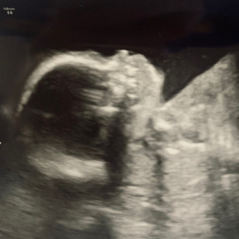 Babylist Registry Photo.