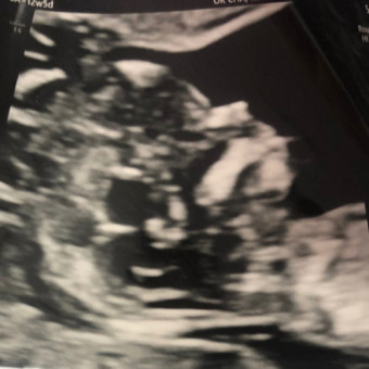 Babylist Registry Photo.