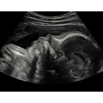 Babylist Registry Photo.