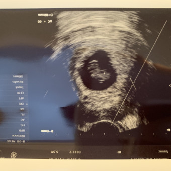 Babylist Registry Photo.