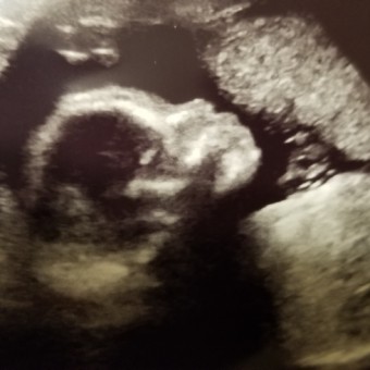 Babylist Registry Photo.
