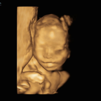 Babylist Registry Photo.