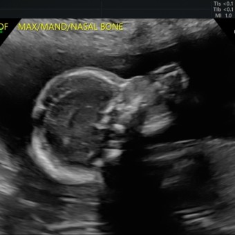 Babylist Registry Photo.