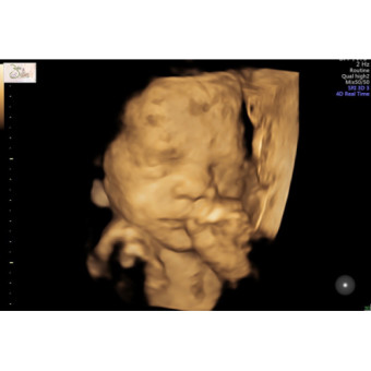 Babylist Registry Photo.