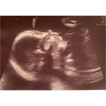 Babylist Registry Photo.