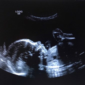 Babylist Registry Photo.