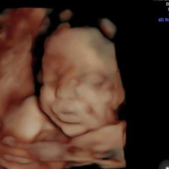 Babylist Registry Photo.