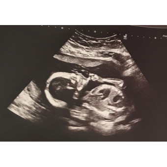 Babylist Registry Photo.