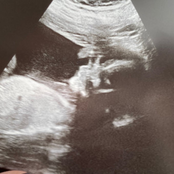 Babylist Registry Photo.