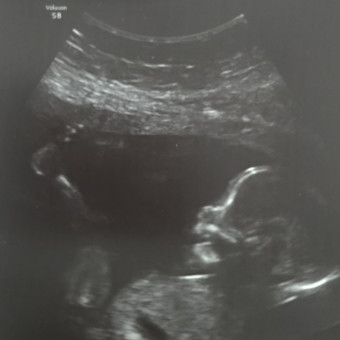 Babylist Registry Photo.