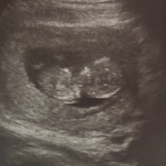 Babylist Registry Photo.