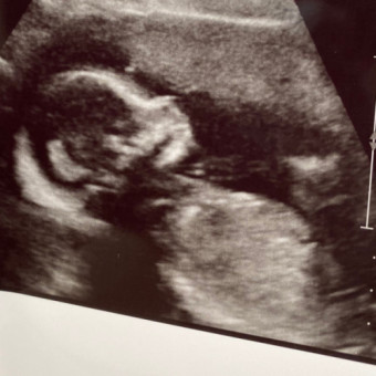 Babylist Registry Photo.