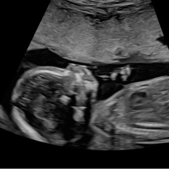Babylist Registry Photo.