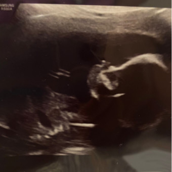 Babylist Registry Photo.