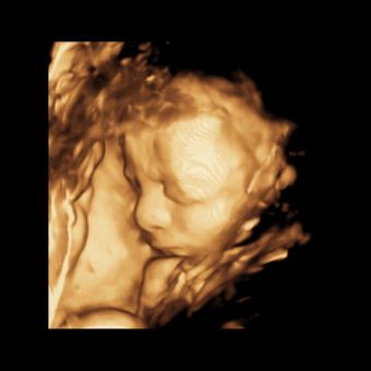 Babylist Registry Photo.