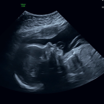 Babylist Registry Photo.