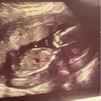 Babylist Registry Photo.