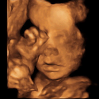 Babylist Registry Photo.