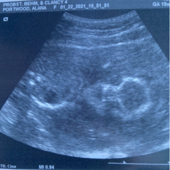 Babylist Registry Photo.