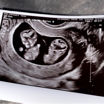 Babylist Registry Photo.