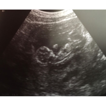Babylist Registry Photo.