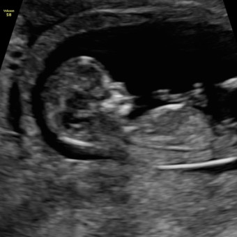 Babylist Registry Photo.