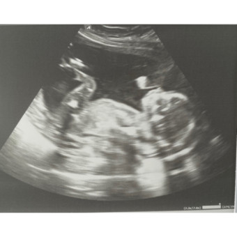 Babylist Registry Photo.
