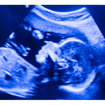Babylist Registry Photo.
