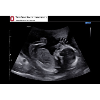 Babylist Registry Photo.