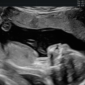Babylist Registry Photo.