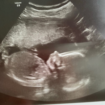 Babylist Registry Photo.