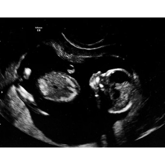 Babylist Registry Photo.