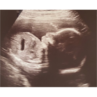 Babylist Registry Photo.