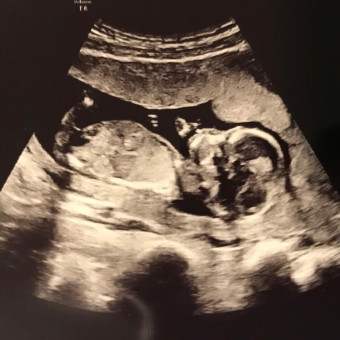 Babylist Registry Photo.