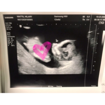 Babylist Registry Photo.