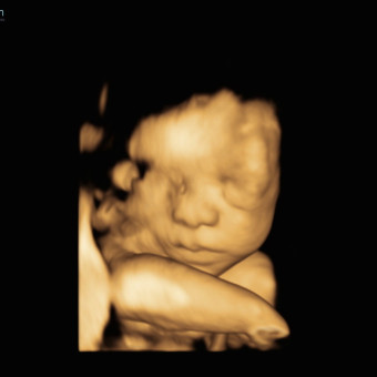 Babylist Registry Photo.