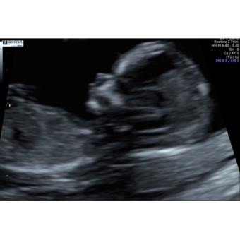 Babylist Registry Photo.