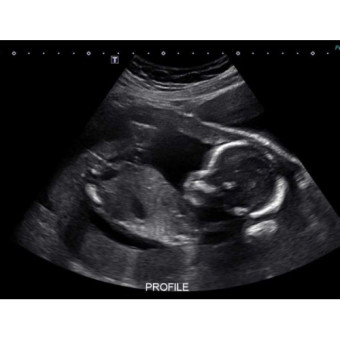 Babylist Registry Photo.