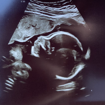 Babylist Registry Photo.