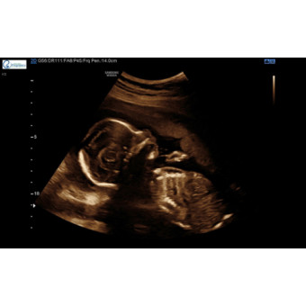 Babylist Registry Photo.