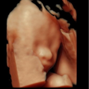 Babylist Registry Photo.