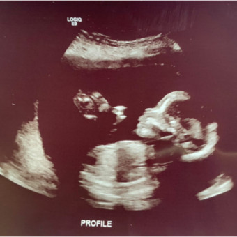 Babylist Registry Photo.